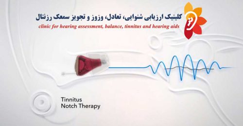 درمان وزوز گوش بوسیله ترکیبی از سمعک و شکاف صوتی