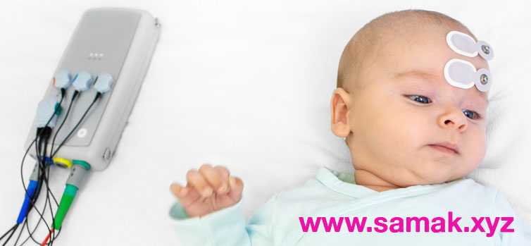 آزمون ABR در کودکان و نوزادان : نصب الکترودهایی بر روی سر و پشت گوش