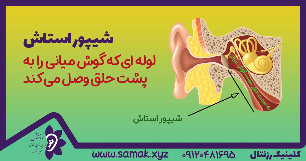 یکی از عوامل درد گوش بد عملکردی شیپور استاش می باشد